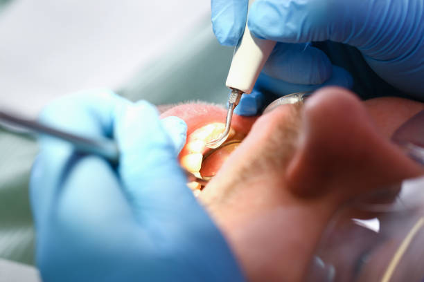 Best Weekend Emergency Dentist in Jackson, OH